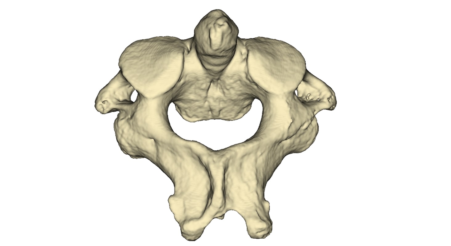 Axis Vertebra Definition Biology at Hannah Benn blog