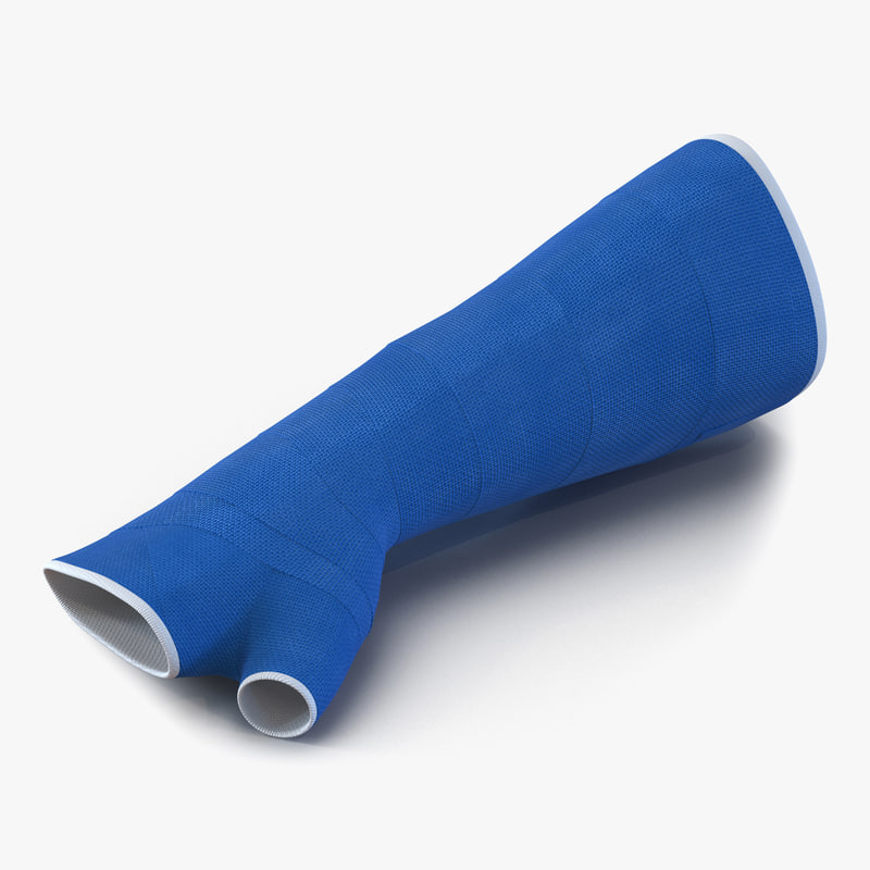 3d blue fiberglass cast arm